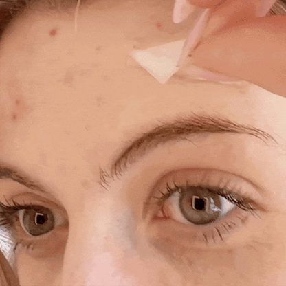 Hydrocolloid Treatment