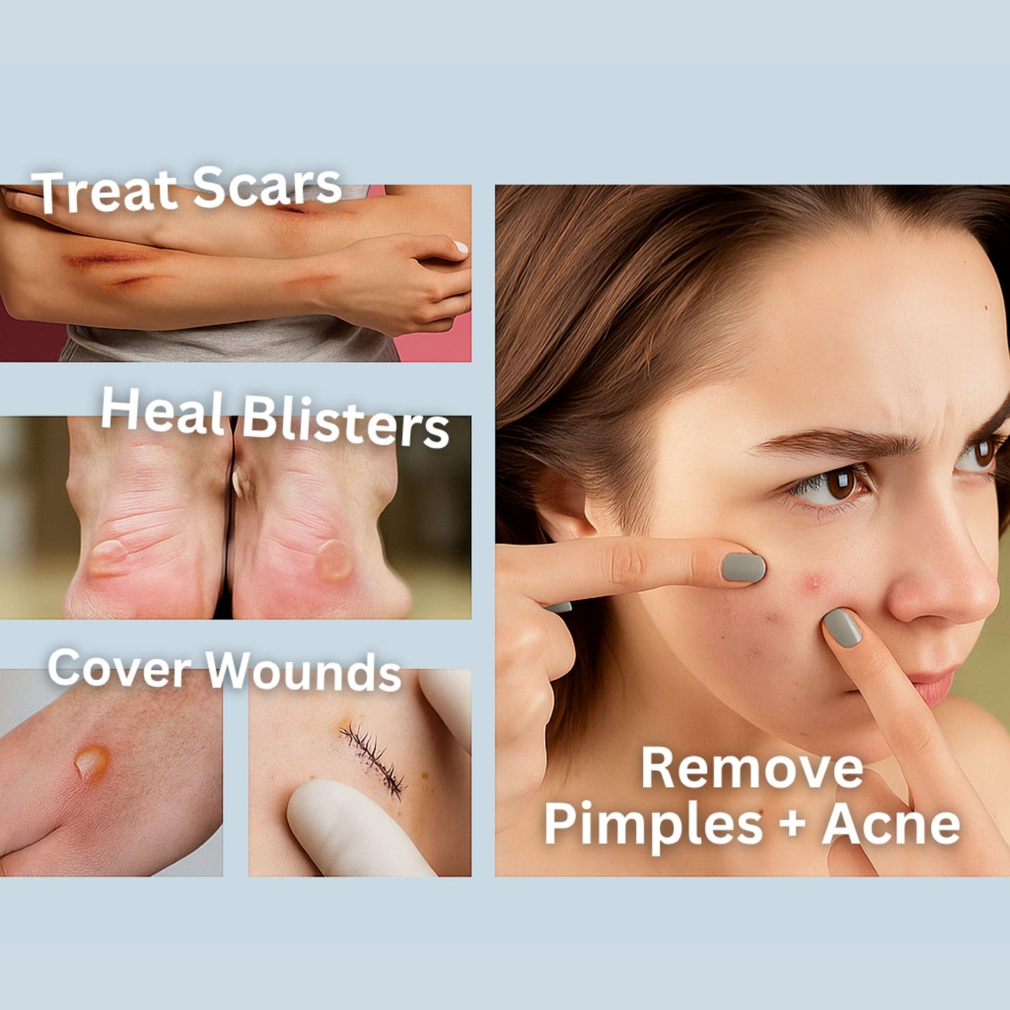 Hydrocolloid Treatment